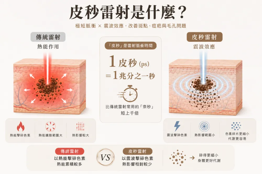 皮秒雷射是什麼? 毛孔、痘疤、斑點會好嗎?醫美新手完整解惑
